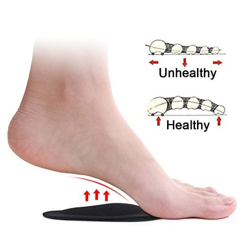 Dr. Foot's Arch Support Insoles for Flat Feet and Plantar Fasciitis (Black)